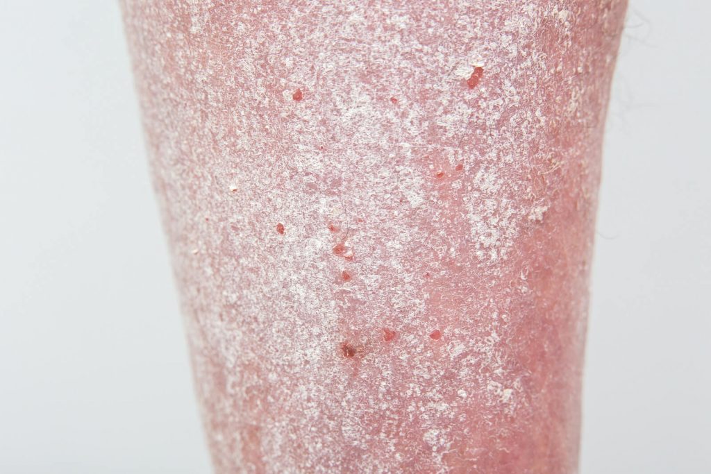 Symptoms Dr David Smith